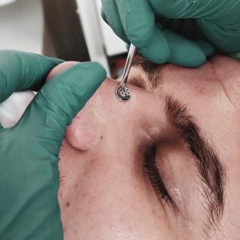 Lazermed, Чернівці Фото - 20