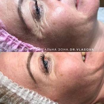 Фото с портфолио Катерина Власова 