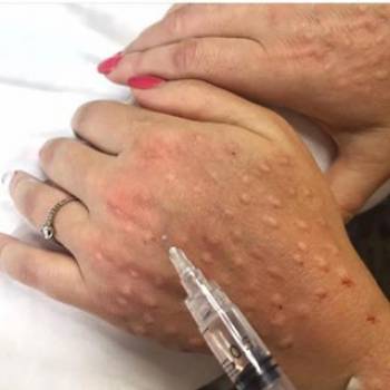 Ірина Бежан, Чернівці Фото - 16