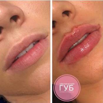 Фото с портфолио Наталия Фацул 