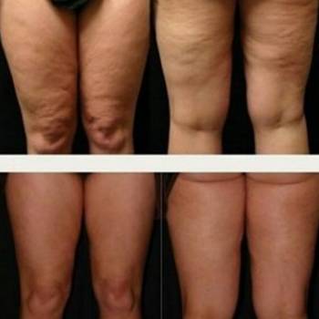 Фото с портфолио Геннадій 