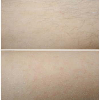 Шугаринг ніг(повністю).
Тривалість 45хв.