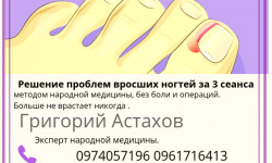 Вросшие ногти, убираем раз и навсегда! Майстер манікюру Татьяна Землякова Одеса