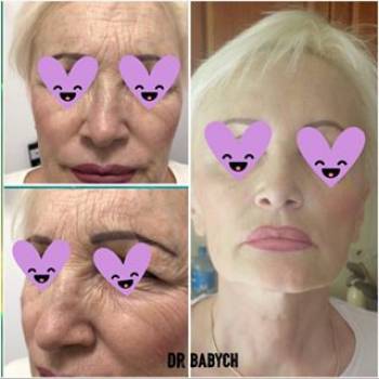 Фото с портфолио Тетяна Бабіч 