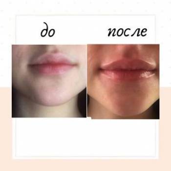 Телейос, Ровно Фото - 5