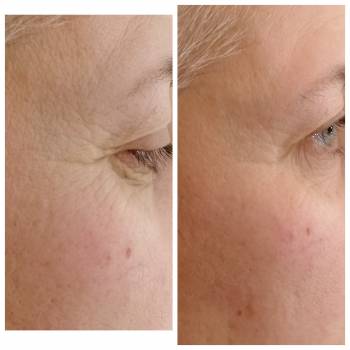 Результат 1 процедуры