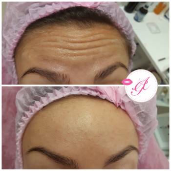 Анастасия Гураевская , Николаев Фото - 5