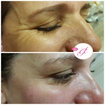 Анастасия Гураевская , Николаев Фото - 6