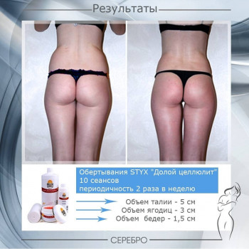 Виски пеленание STYX
                    Косметологический центр Серебро Одесса