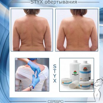 Виски пеленание STYX
                    Косметологический центр Серебро Одесса