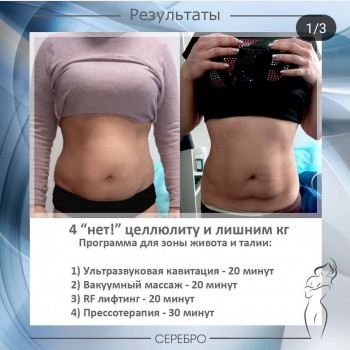 Кавитация (в зависимости от зоны)
                    Косметологический центр Серебро Одесса