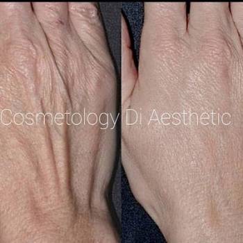 Di aesthetic, Хмельницький Фото - 11