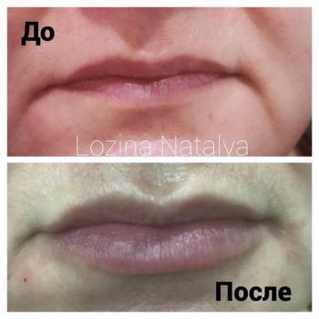 Лозина Наталья , Хмельницкий Фото - 6