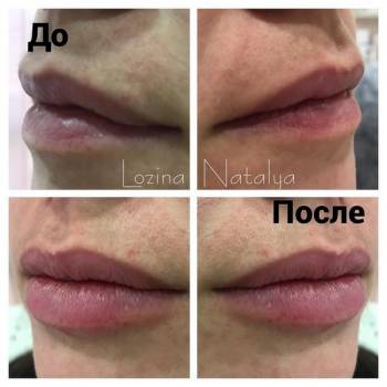 Лозина Наталья , Хмельницкий Фото - 7