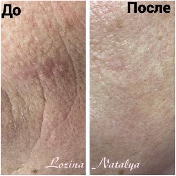 Лозина Наталья , Хмельницкий Фото - 9