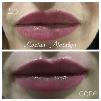 Лозина Наталья , Хмельницкий Фото - 10