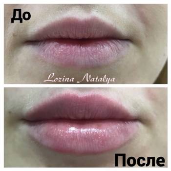 Лозина Наталья , Хмельницкий Фото - 11