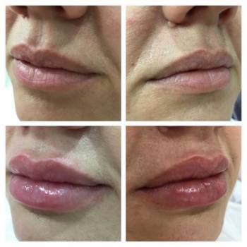 Лозина Наталья , Хмельницкий Фото - 1