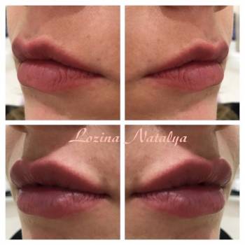 Лозина Наталья , Хмельницкий Фото - 13