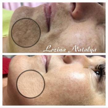 Лозина Наталья , Хмельницкий Фото - 14