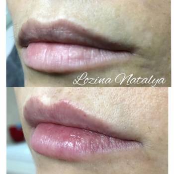 Лозина Наталья , Хмельницкий Фото - 15