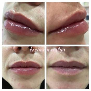 Лозина Наталья , Хмельницкий Фото - 16