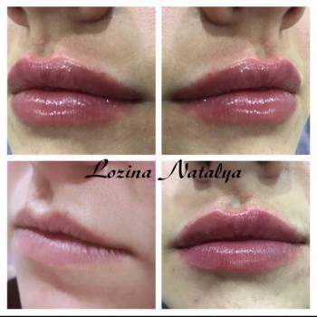 Лозина Наталья , Хмельницкий Фото - 20