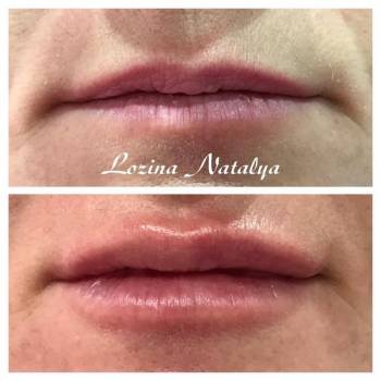 Лозина Наталья , Хмельницкий Фото - 23