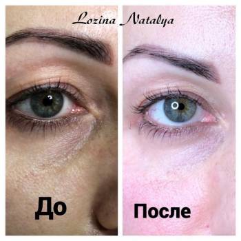 Лозина Наталья , Хмельницкий Фото - 24