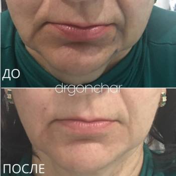 Фото с портфолио Ванда Гончар 