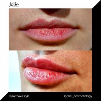 Jolie, Хмельницкий Фото - 1