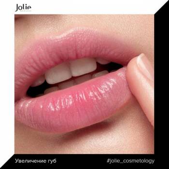 Jolie, Хмельницкий Фото - 29