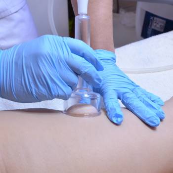 Вакуумний масаж