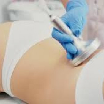 Антицеллюлитный аппаратный массаж
                    Салон краси Rebelle Одеса