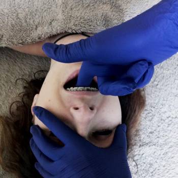 Остеопатия при брекетах