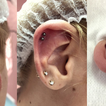 Процесс- ровный прокол