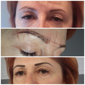 Татуаж (все зоны)
                    Косметолог Марина Ирпень