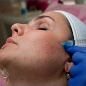 Мезотерапия
                    Косметологічний центр Надія Кривий Ріг