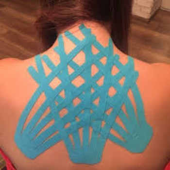 тейпирование