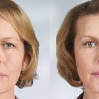 тейпирование до и после