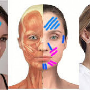 тейпирование