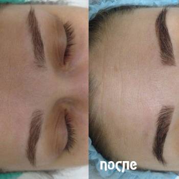 Фото с портфолио Формула молодости