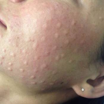 Бронислава Хачатурова , Харків Фото - 5