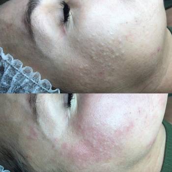 Бронислава Хачатурова , Харків Фото - 10