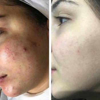 Бронислава Хачатурова , Харків Фото - 11