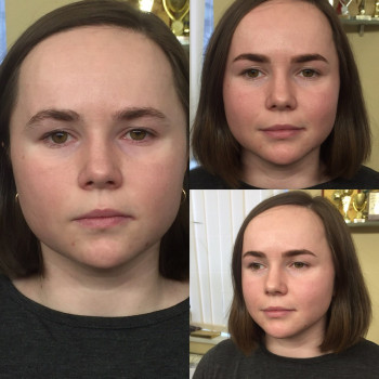 Покраска и архитектура бровей
                    Косметологический центр Надія Кривой Рог