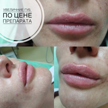 Фото с портфолио Надія