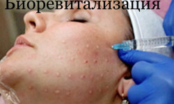 Биоревитализация Косметолог Мария Лихобицкая Днепр