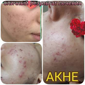 Елена Шулаева, Харьков Фото - 16