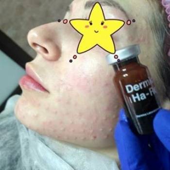 Alian, Ивано-Франковск Фото - 5